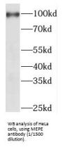 Matrix Extracellular Phosphoglycoprotein (MEPE) Antibody