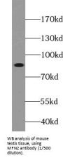 Mitofusin-2 (MFN2) Antibody