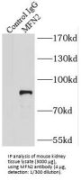Mitofusin-2 (MFN2) Antibody