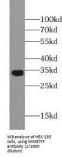 MKI67IP Antibody
