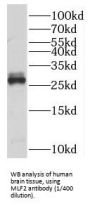 Myeloid Leukemia Factor 2 (MLF2) Antibody