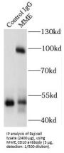 Neprilysin / NEP (MME) Antibody
