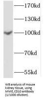 Neprilysin / NEP (MME) Antibody