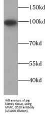 Neprilysin / NEP (MME) Antibody