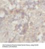 Matrix Metalloproteinase 9 (MMP9) Antibody