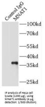 CDK7/Cyclin-H Assembly Factor (MNAT1) Antibody
