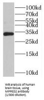 Metallophosphoesterase Domain-Containing Protein 2 (MPPED2) Antibody