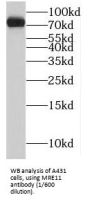 Double-strand break repair protein MRE11A (MRE11) Antibody