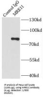 Double-strand break repair protein MRE11A (MRE11) Antibody
