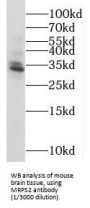 Mitochondrial Ribosomal Protein S2 (MRPS2) Antibody