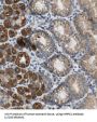 Mitochondrial Ribosomal Protein S2 (MRPS2) Antibody
