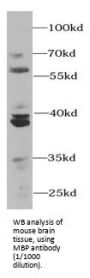 Myelin Basic Protein (MBP) Antibody