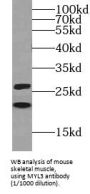 Myosin Light Chain 3 (MYL3) Antibody