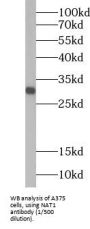 N-Acetyltransferase 1 (NAT1) Antibody