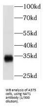 N-Acetyltransferase 1 (NAT1) Antibody