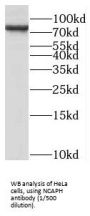 Condensin Complex Subunit 2 (NCAPH) Antibody