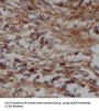 Condensin Complex Subunit 2 (NCAPH) Antibody
