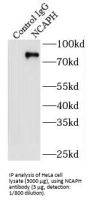 Condensin Complex Subunit 2 (NCAPH) Antibody