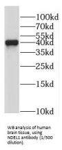 NudE Neurodevelopment Protein 1 Like 1 (NDEL1) Antibody