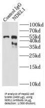 NudE Neurodevelopment Protein 1 Like 1 (NDEL1) Antibody