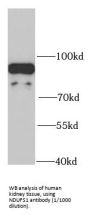 NADH Ubiquinone Oxidoreductase Core Subunit S1 (NDUFS1) Antibody