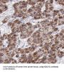 NADH Ubiquinone Oxidoreductase Core Subunit S1 (NDUFS1) Antibody
