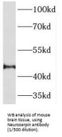 Neuroserpin (SERPINI1) Antibody