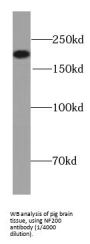 NF200 Antibody