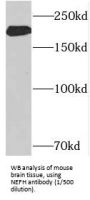 NF-H Antibody