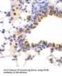Nuclear Factor NF-Kappa-B P105 Subunit (NFKB1) Antibody
