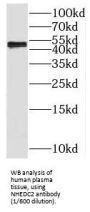 Solute Carrier Family 9 Member B2 (NHEDC2) Antibody