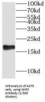 NHP2 Ribonucleoprotein (NHP2) Antibody