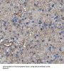 Cyclin-Dependent Kinase-Like 3 (CDKL3) Antibody