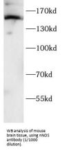 Nitric Oxide Synthase, Brain (NOS1) Antibody