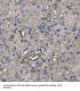 Noggin (NOG) Antibody