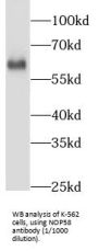 Nucleolar Protein 58 (NOP58) Antibody