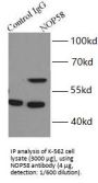 Nucleolar Protein 58 (NOP58) Antibody