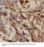 Odontogenic Ameloblast-Associated Protein (ODAM) Antibody