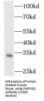 2-Oxoglutarate And Iron Dependent Oxygenase Domain Containing 2 (OGFOD2) Antibody