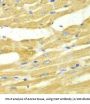 UDP-N-Acetylglucosamine--Peptide N-Acetylglucosaminyltransferase 110 kDa Subunit (OGT) Antibody
