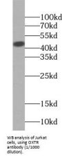 Oxytocin Receptor (OXTR) Antibody