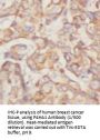 Prolyl 4-Hydroxylase Subunit Alpha-1 (P4HA1) Antibody