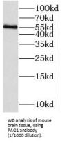 Pregnancy-Associated Glycoprotein 1 (PAG1) Antibody