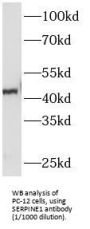Plasminogen Activator Inhibitor 1 (PAI-1) Antibody