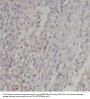 Plasminogen Activator Inhibitor 1 (PAI-1) Antibody
