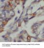 Pantothenate Kinase 2 (PANK2) Antibody