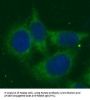Pantothenate Kinase 2 (PANK2) Antibody