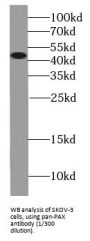 Paired Box Protein Pax-8 (PAX8) Antibody