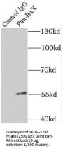 Paired Box Protein Pax-8 (PAX8) Antibody
