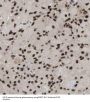 PARK7,DJ-1 Antibody